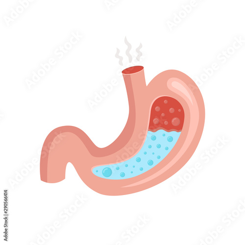 Stomach acid reflux. Healthcare. Digestion. Disease, stomachache. Vector illustration.
