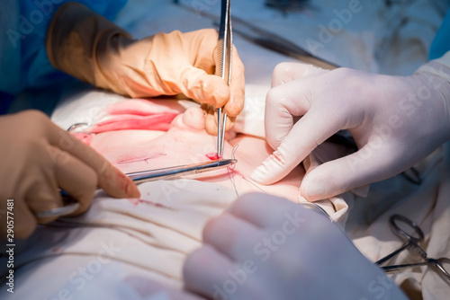 surgical suture. The hands of the surgeon and assistant in a sterile operating room impose a cosmetic suture on the skin of the patient's child.