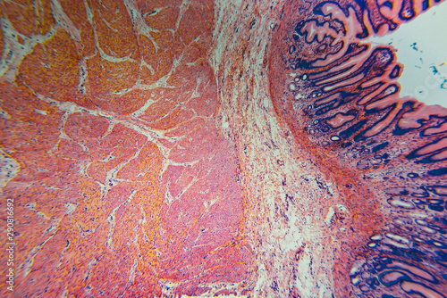 Foto Cell microscopic- pyloric division stomach