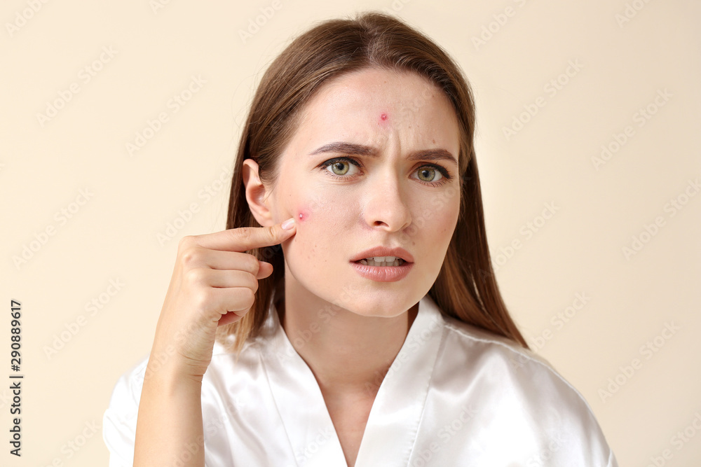Portrait of young woman with acne problem on light background Portrait of young woman with acne problem on light background