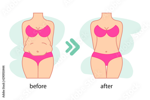 Fat and slim woman figure, before and after weight loss. Women waist, weight loss, diet, waistline line icon. Vector illustration.
