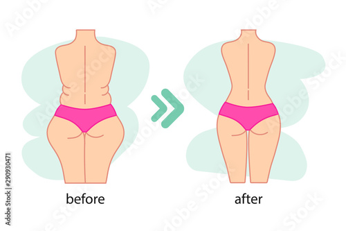 Fat and slim woman figure, before and after weight loss. Women's waist and buttocks weight loss, diet, waistline line icon. Vector illustration.
