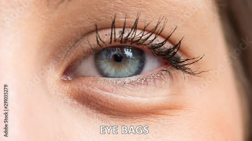Comparisons between a young eye and possible imperfections