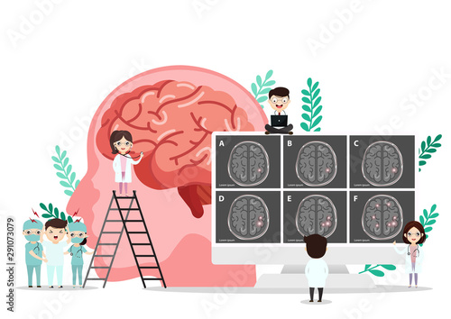 Scientific medical illustration of human brain stroke illustration