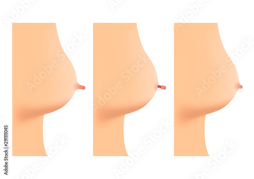 nipple breast reduction vector / infographic / plastic surgery