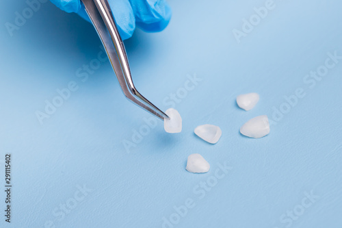 Dentist holds a veneer with tweezers against a background of lying veneers
