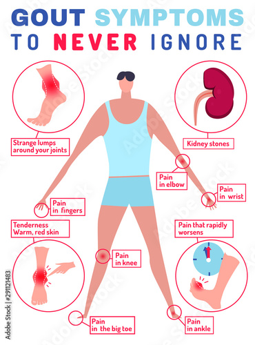 Gout arthritis infographic.