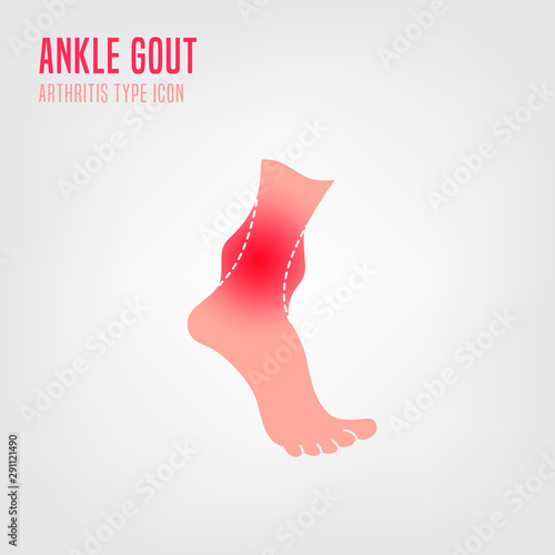 Gout arthritis icon photo