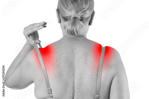 Woman with irritated skin under bra, irritation on the body from underwear isolated on white background