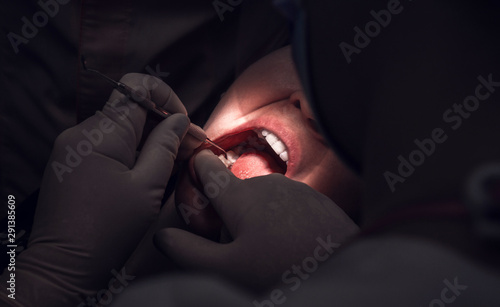 tdentistry. dental treatment, close-up. teeth and caries.