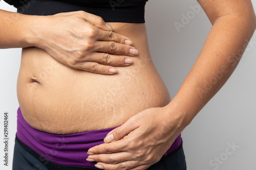 Fotografie Women Show off the belly after birth