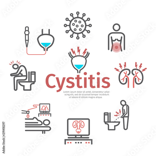 Cystitis banner. Symptoms, Treatment. Vector signs for web graphics.