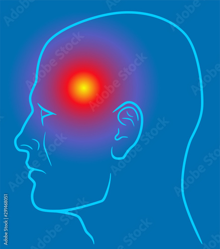 Head pain line illustration