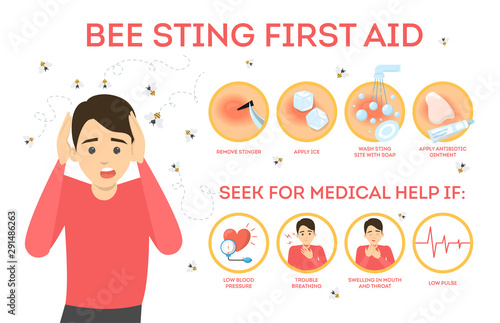 Bee sting first aid infographic. Remove sting from the skin