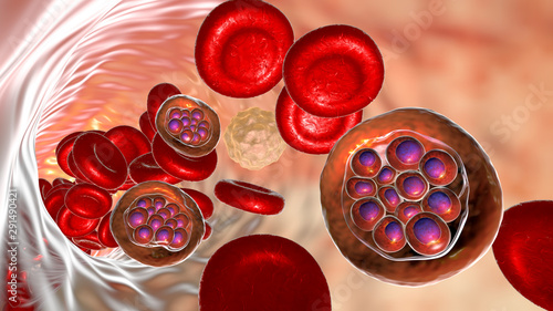 The malaria-infected red blood cells. 3D illustration showing malaria parasite Plasmodium vivax inside red blood cells in schizont stage