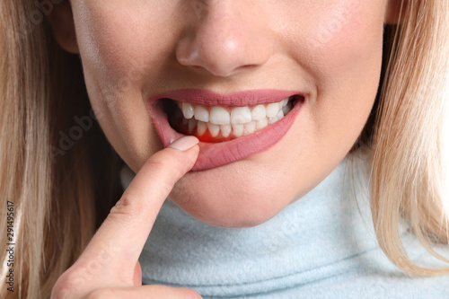 Woman with gum inflammation, closeup