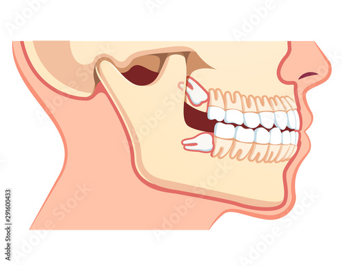 Human jaws model with teeth row. Dentistry