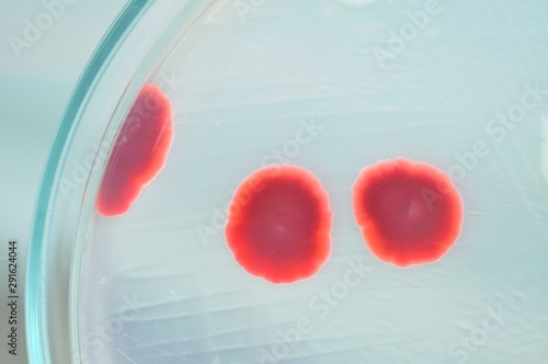 Obraz na plátně red colony of bacteria in mircobiology laboratory