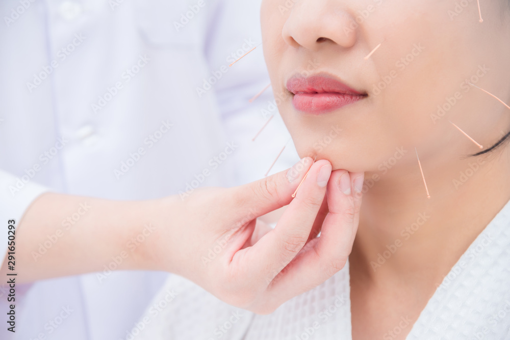 Asian woman receiving facial acupuncture treatment at clinic ,Alternative medicine concept. Asian woman receiving facial acupuncture treatment at clinic ,Alternative medicine concept.