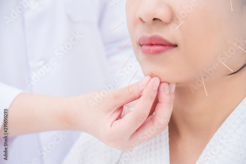 Asian woman receiving facial acupuncture treatment at clinic ,Alternative medicine concept.