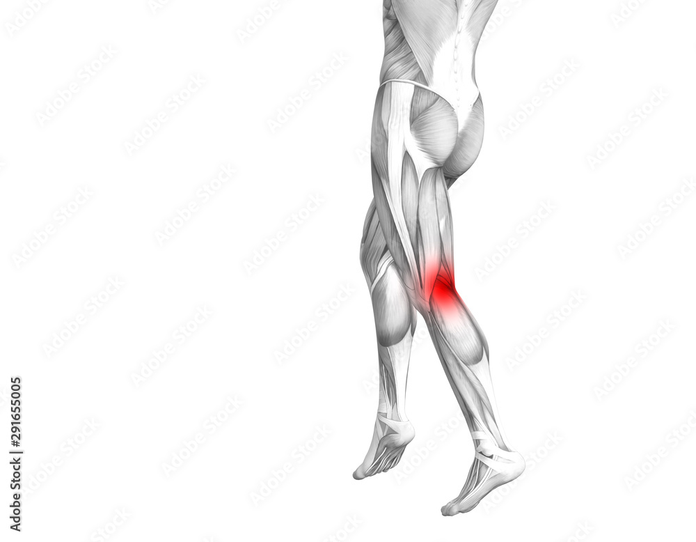 Conceptual knee human anatomy with red hot spot inflammation or articular joint pain for leg health care therapy or sport muscle concepts. 3D illustration man arthritis or bone osteoporosis disease Conceptual knee human anatomy with red hot spot inflammation or articular joint pain for leg health care therapy or sport muscle concepts. 3D illustration man arthritis or bone osteoporosis disease