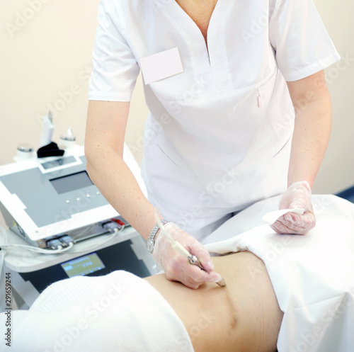 Laser removal of scars and scars on the abdomen of a woman