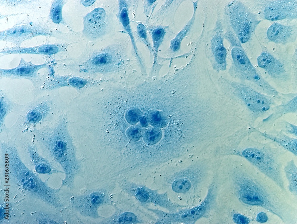 Naklejka premium HeLa cervical cancer cells