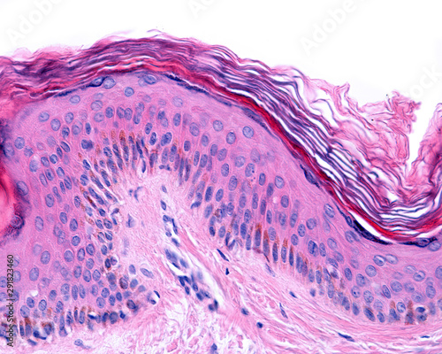 Quadro su tela Melanocytes. Epidermis.