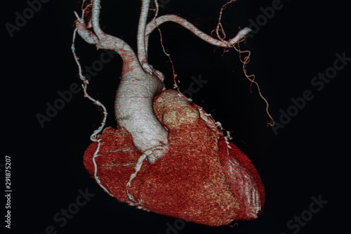 Wallpaper Mural X-ray medical scan heart in hospital. CTA, CT angiography 3D rendering image, CT Scan. Healthcare and Medical concept. Torontodigital.ca
