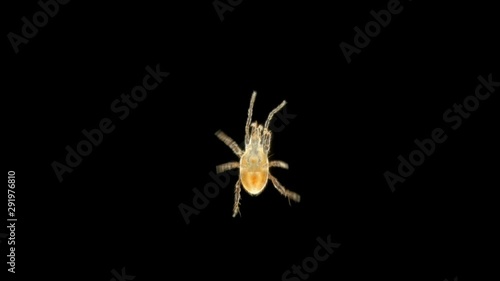 a tick of the order Mesostigmata under a microscope, class Arachnida, superorder Parasitiformes, this group has many parasites, predators and saprotrophs are also numerous, on the back we can photo