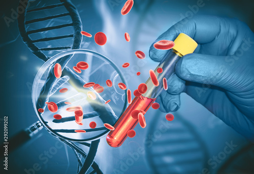 Tableau sur toile Test finds the first signs of a tumor in the blood, Based on DNA analysis for th