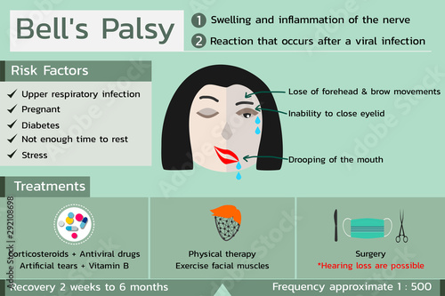 Bell's Palsy infographic in green color tone , vector