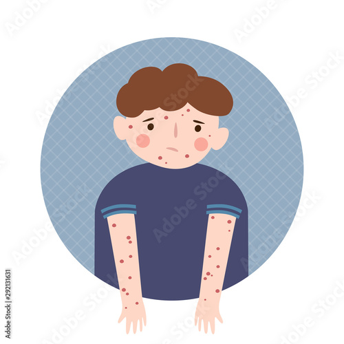 Boy with a rash on the body. Chickenpox, measles, rubella, allergy. Vector illustration in cartoon style