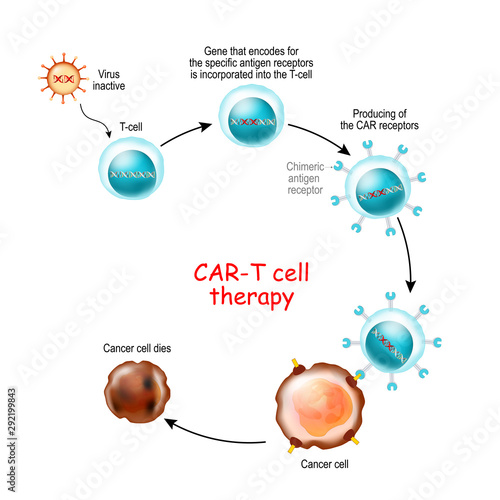 CAR T-cell therapy