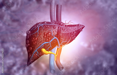 3d illustration of Abstract medical background with Diseased liver photo