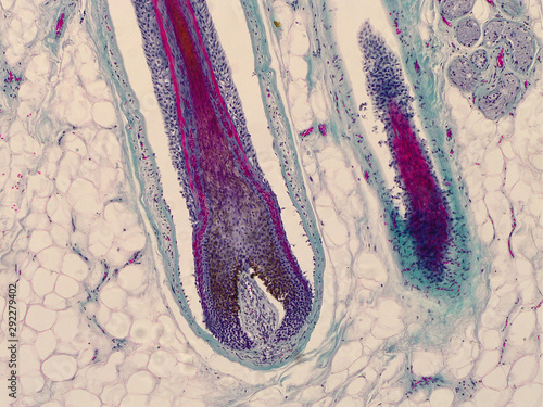 Head skin with hair follicles. Root of hair under the microscope.