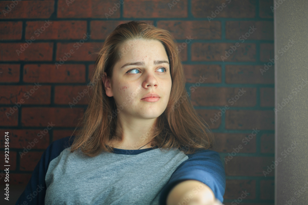 Teenager with problem skin. Portrait of young cute girl with blue eyes in casual clothes near a brick wall indoors. Teenager with problem skin. Portrait of young cute girl with blue eyes in casual clothes near a brick wall indoors.