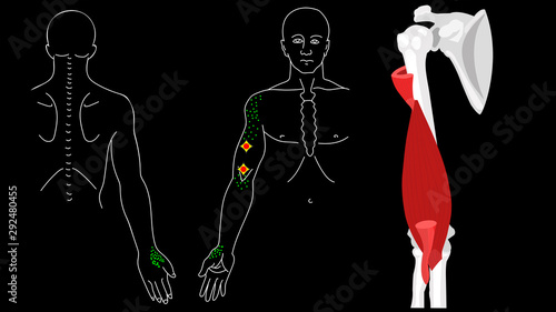 Brachialis muscle. Trigger points in the arm