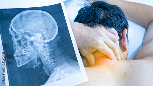 One man use his hand to hold the neck. He felt pain from the neck bone  Herniated Disc and have X-ray film sheet placed near. Concept  neck pain or Cervical Spondylosis. photo