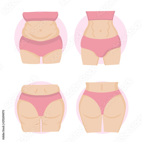 Fat and slim girl, weight loss concept. 