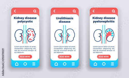 Kidney disease on mobile app onboarding screens. Line icons, polycystic, urolithiasis disease, pyelonephritis.