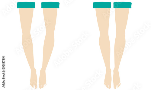 bow-legs and straight-legs illustration set