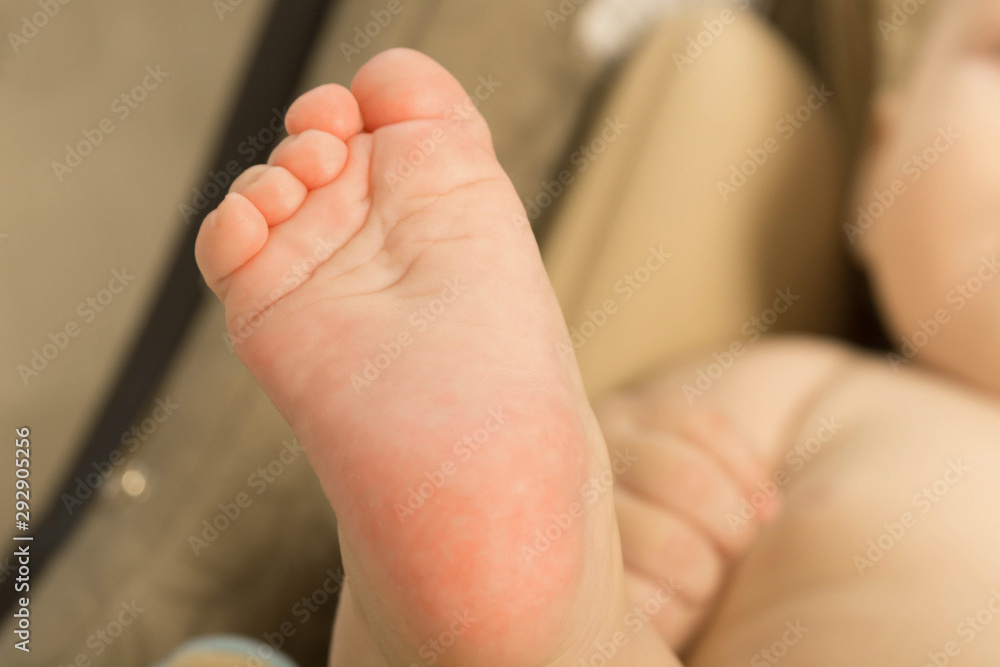 One baby foot with small toes
