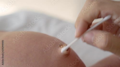cleaning navel for newborn baby using cotton bud photo