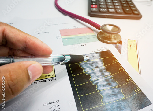 Artificial intelligence in smart healthcare hospital technology concept. Doctor point pen to bone density screen and machine learning detect in X-Rays process.