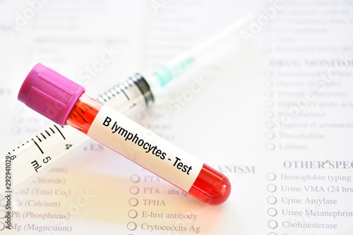 Blood sample tube for B lymphocytes or B cells test
