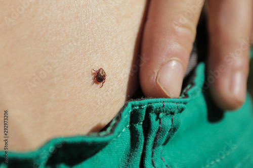Deer tick on skin with a fingernail for scale