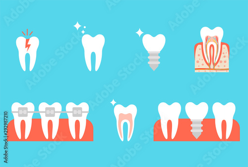 Correction of teeth with orthodontic braces. Tooth anatomy vector dental infographics. Set Health Care Tooth Concept Flat Design Style. Tooth structure. Dental anatomy concept.