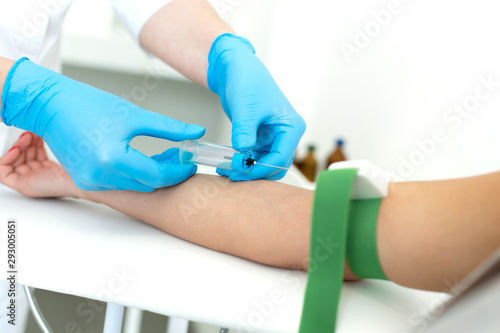 a gloved nurse inserts a needle into a vein on the patients arm and draws blood into a vacuum container. Blood sampling procedure