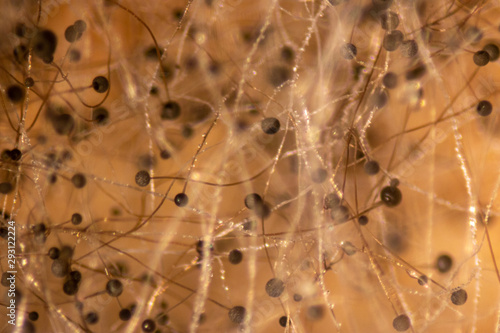 Rhizopus (bread mold) is a genus of common saprophytic fungi,Rhizopus (bread mold) under the microscope. © sinhyu